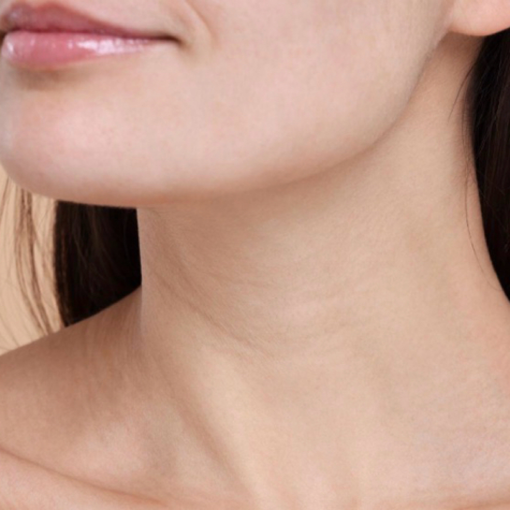 Collagen Growth Add On Neck at Gina Schober Esthetics in 91750