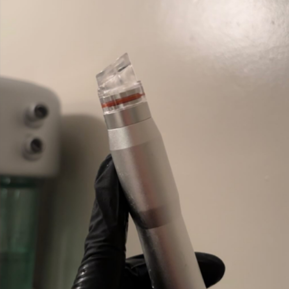 Hydrodermabrasion at The Dermal Clinic in Lodi, CA