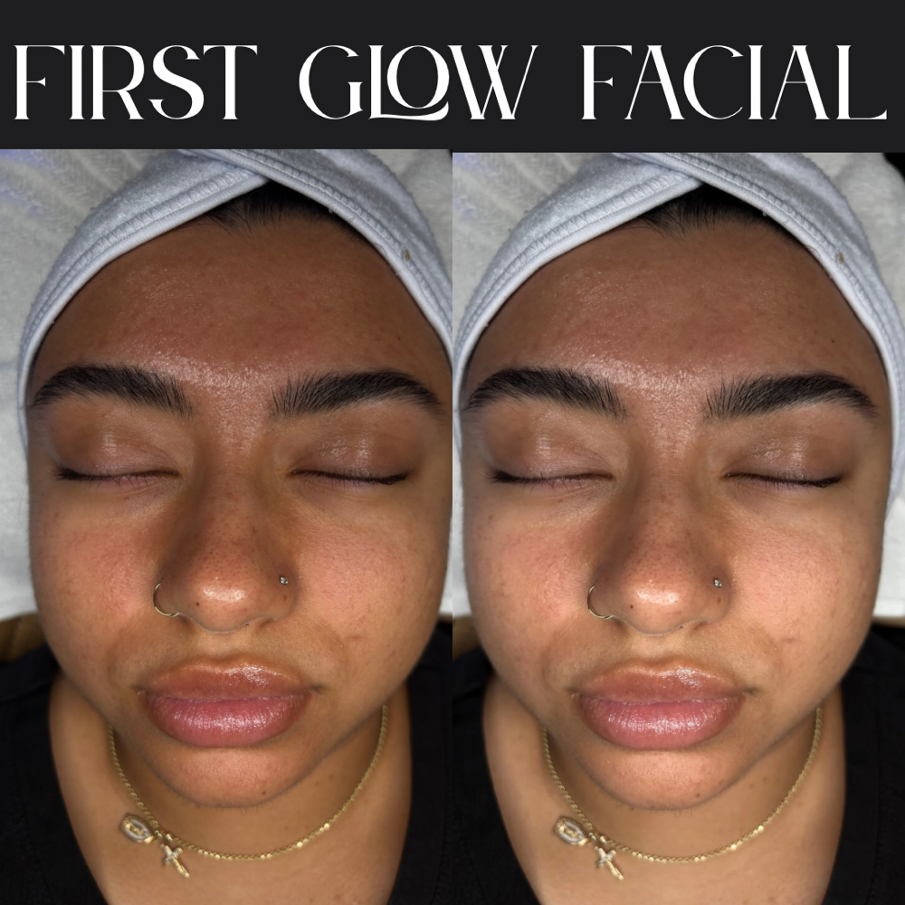 DreamSkin: First Glow