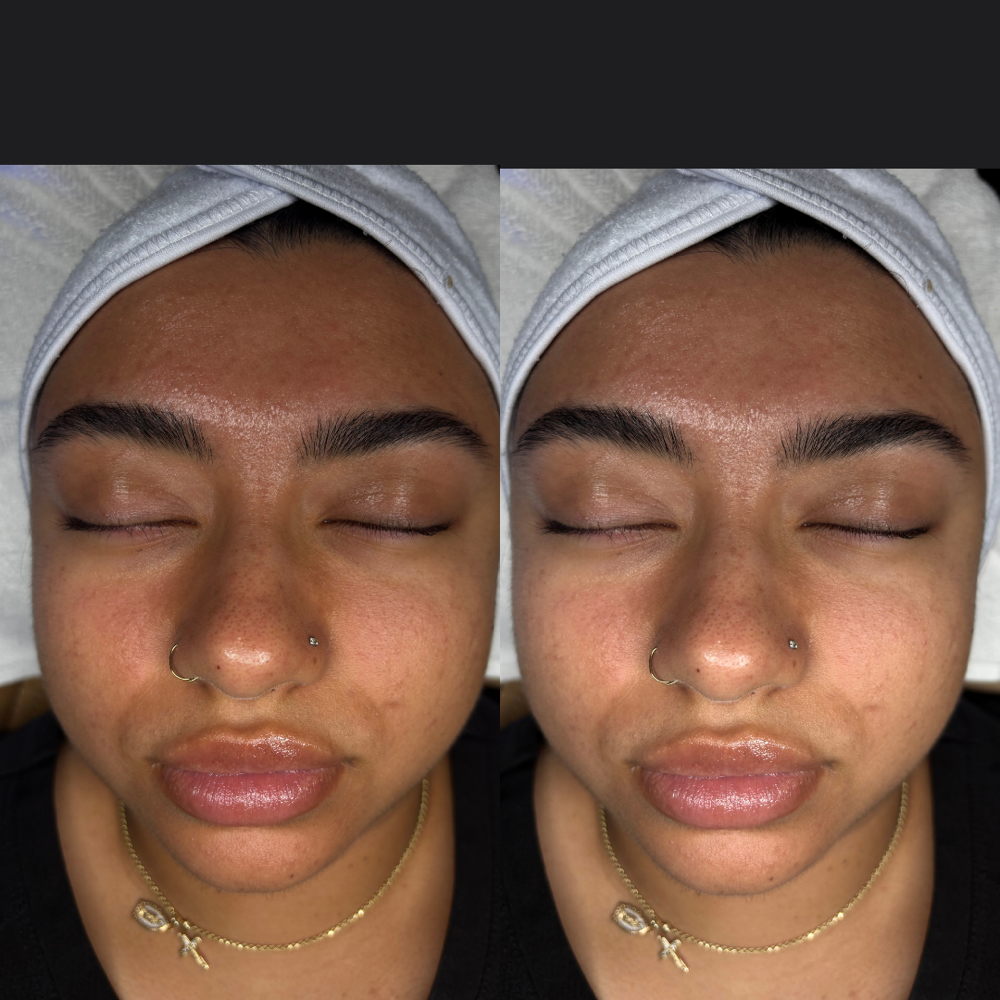 First Glow Facial