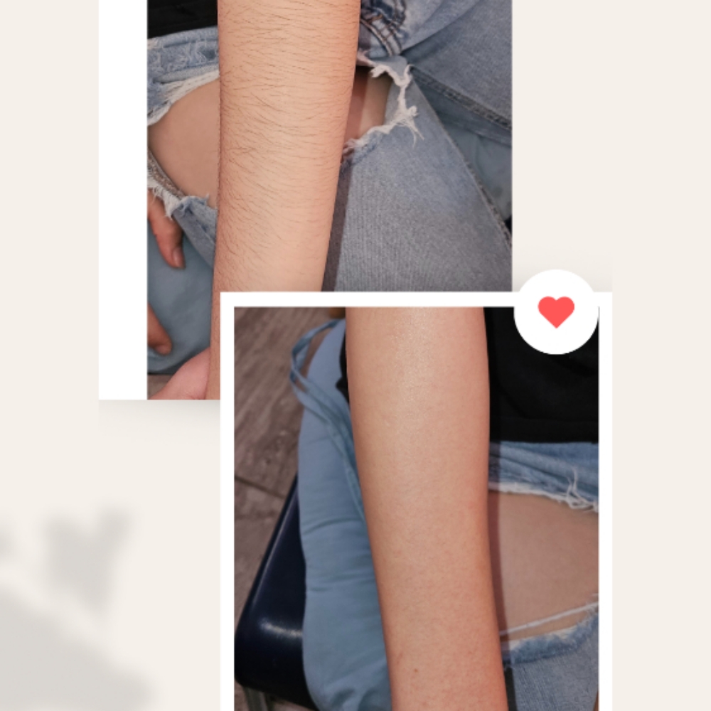 Arm Wax at IYL VIBRANT SKIN STUDIO in El Paso, TX