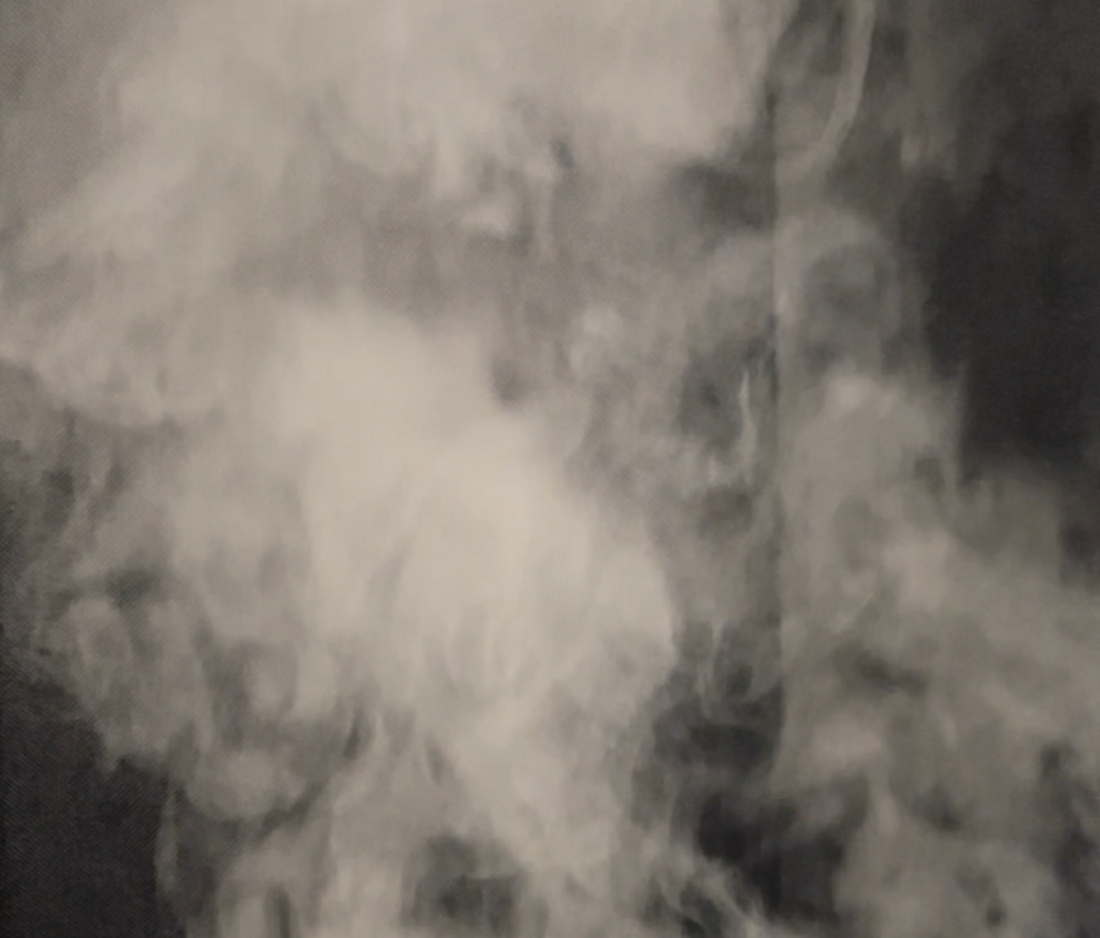 Signature Scalp Facial at Jouvence Skin Health in Findlay, OH