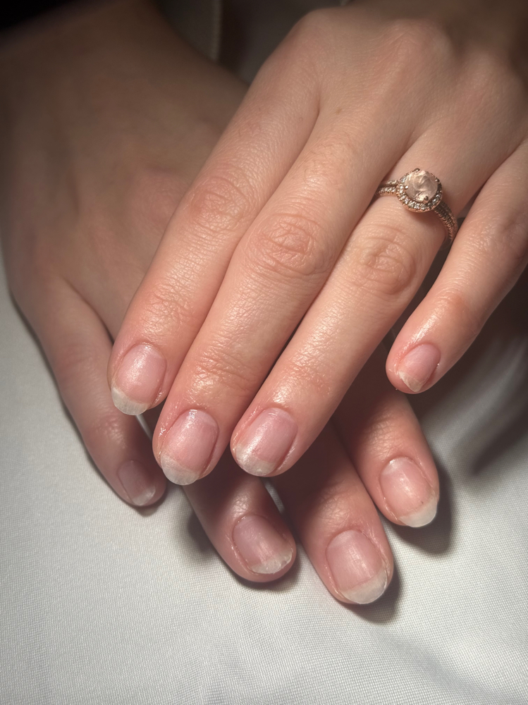 Gel Removal