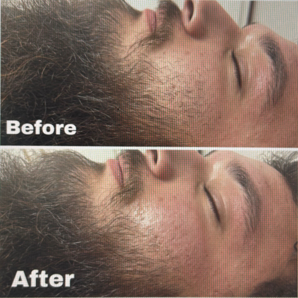 Mens Beard Lineup at Empower Her Esthetics LLC in Oklahoma City, OK