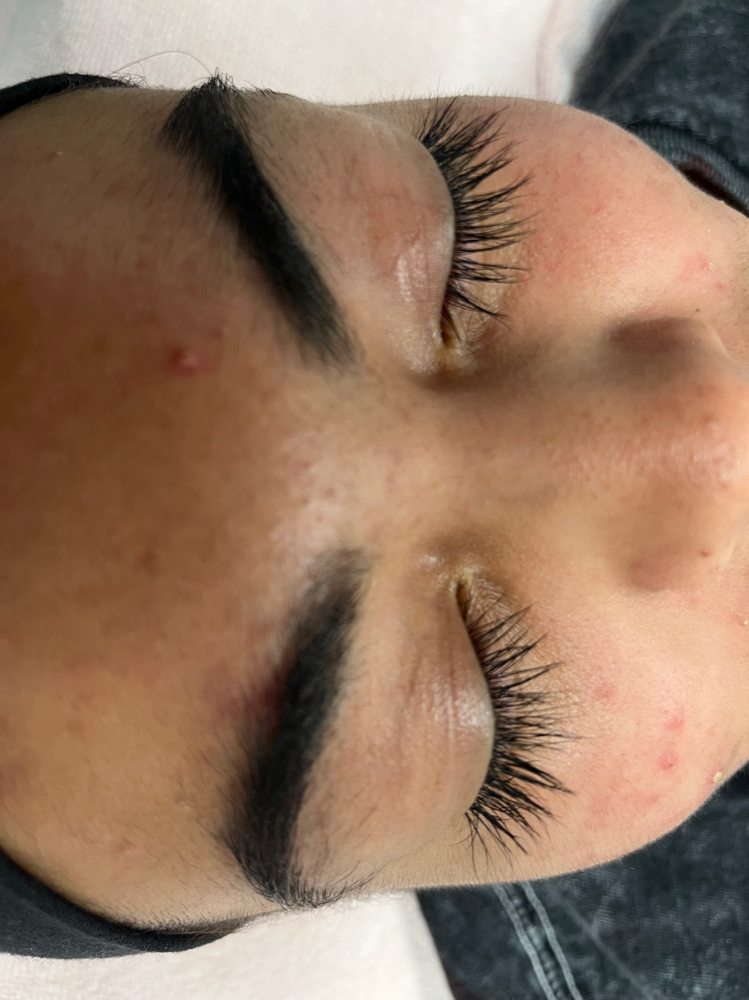 Lash Extension Removal