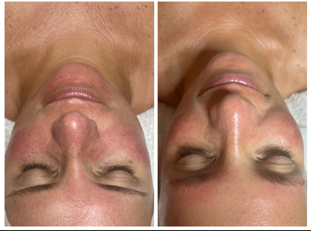 Brow Lamination