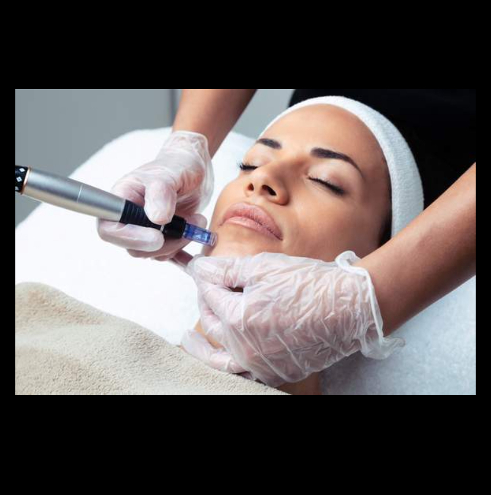 Microneedling