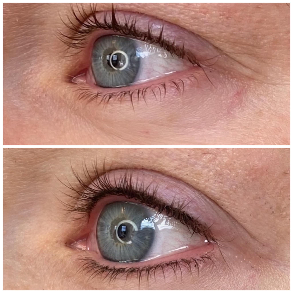 Eye Lash Enhacement