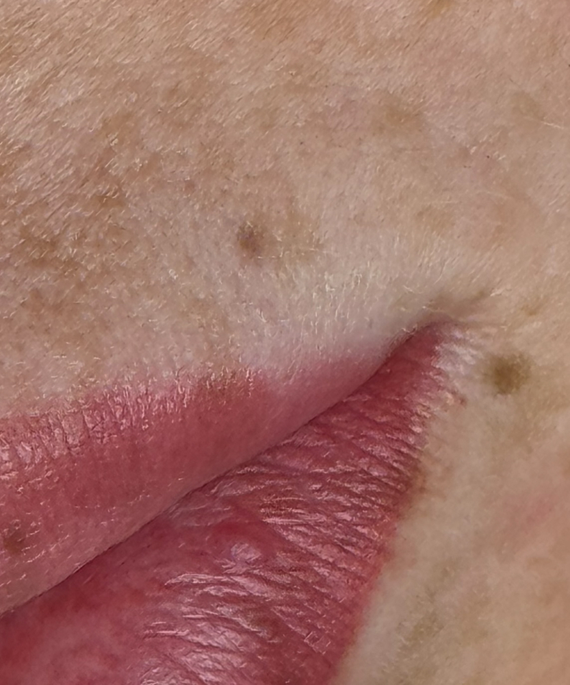 Beauty Marks