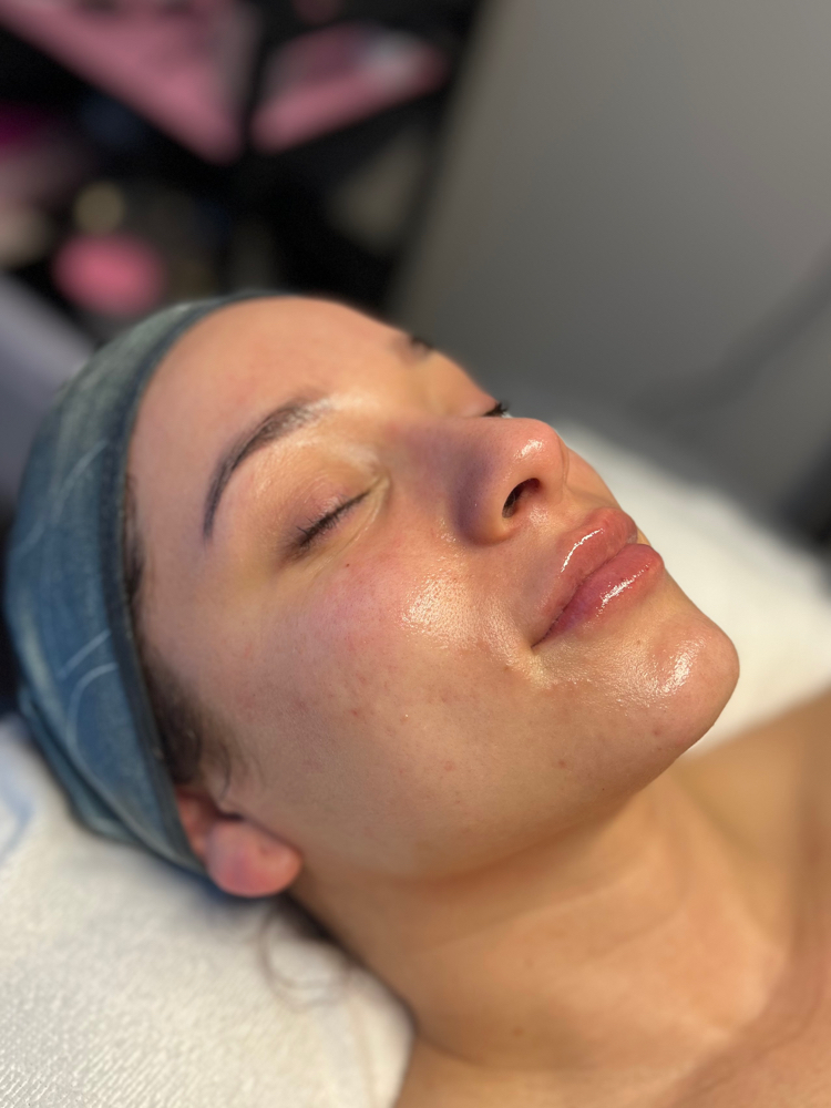 Dermaplane Facial