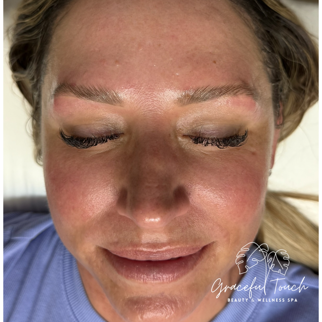 Korean Collagen Thread Fill Facial