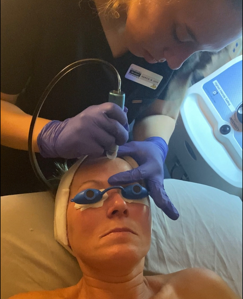 Microdermabrasion Facial