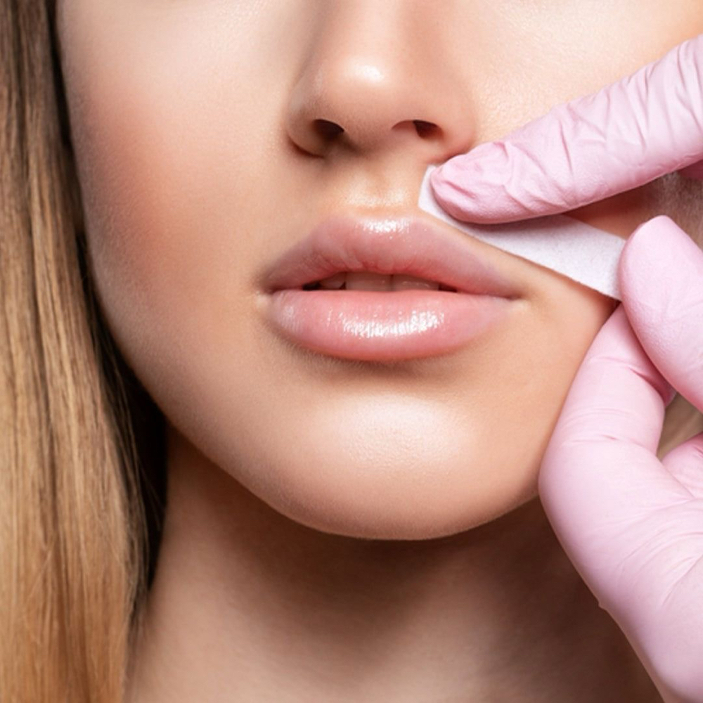 Upper Lip