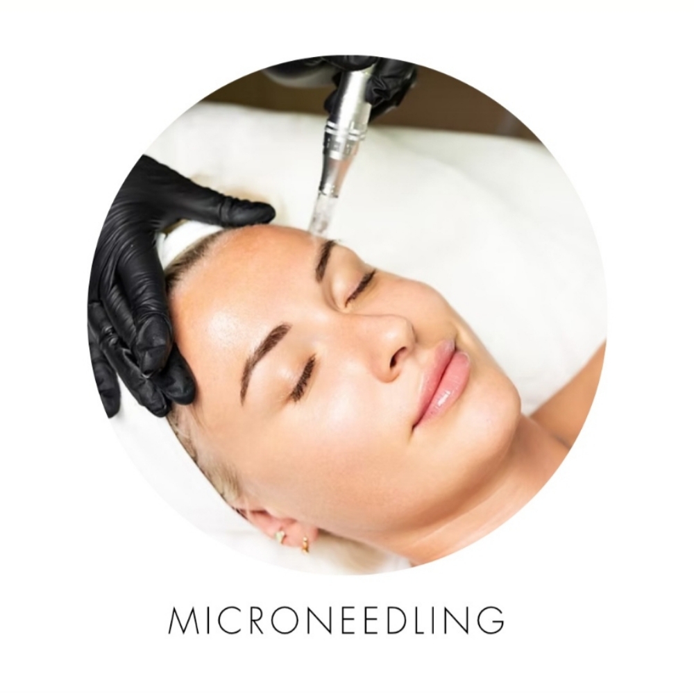 Microneedling at Beauty Care by Monika Wojcieszak in Rockaway, NJ