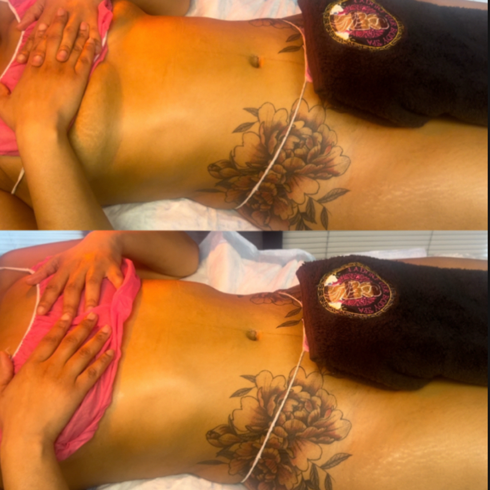 Fall In Love Post Op Package