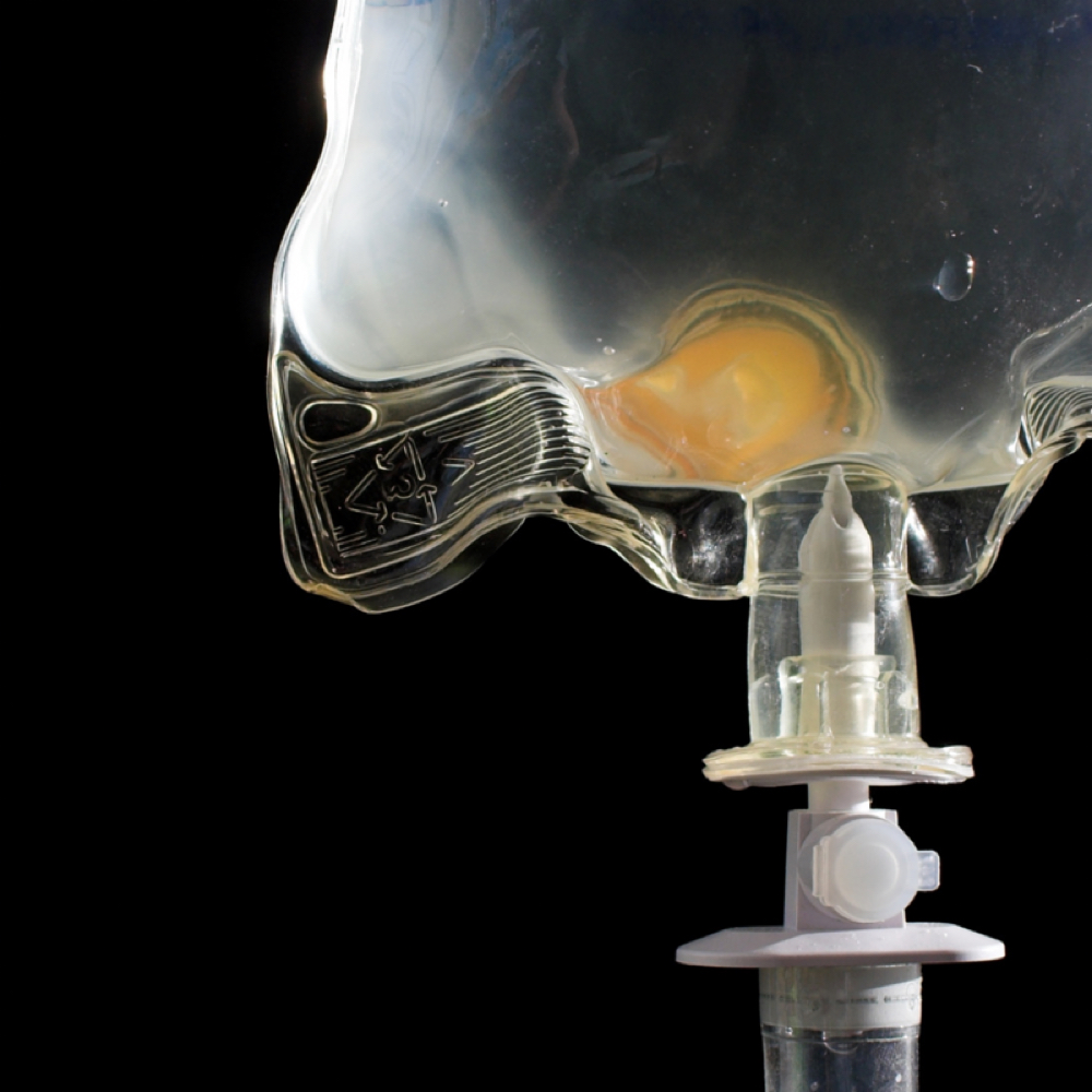 IV Vitamin therapy at THE BYOODE STUDIO in Lombard, IL