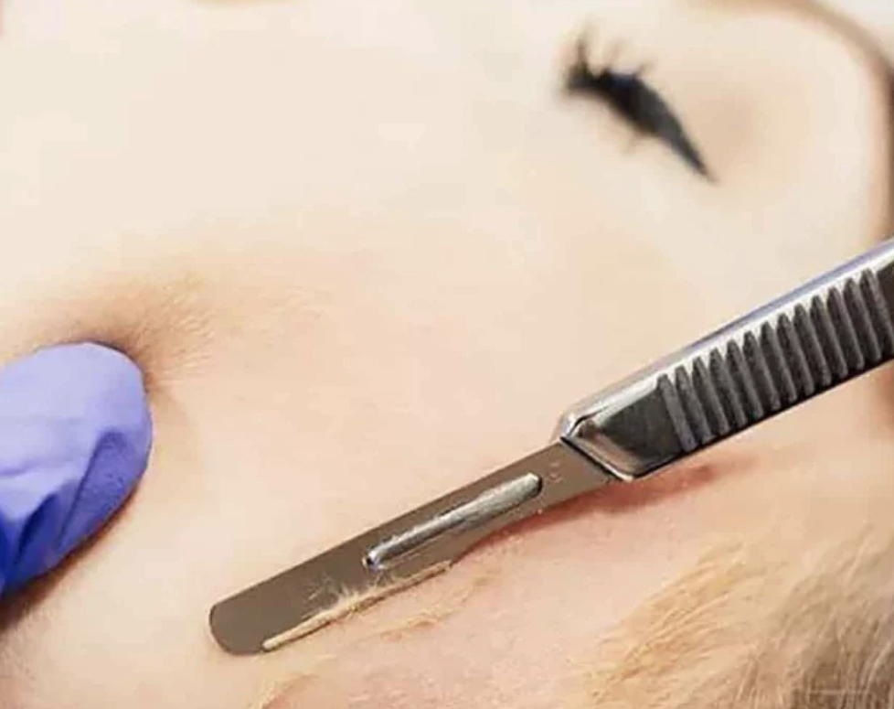 Dermaplaning+Facial