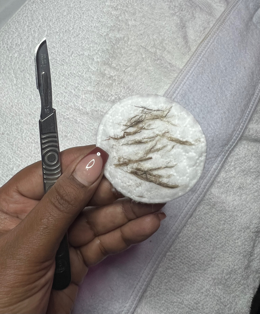 Add On Dermaplane
