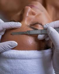 Dermaplaning