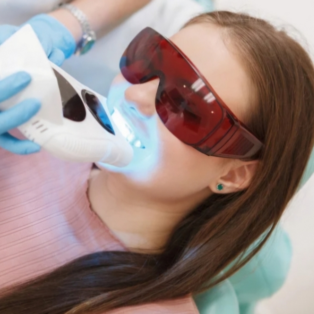 Teeth Whitening at Renue Spa And Wellness in Joliet, IL