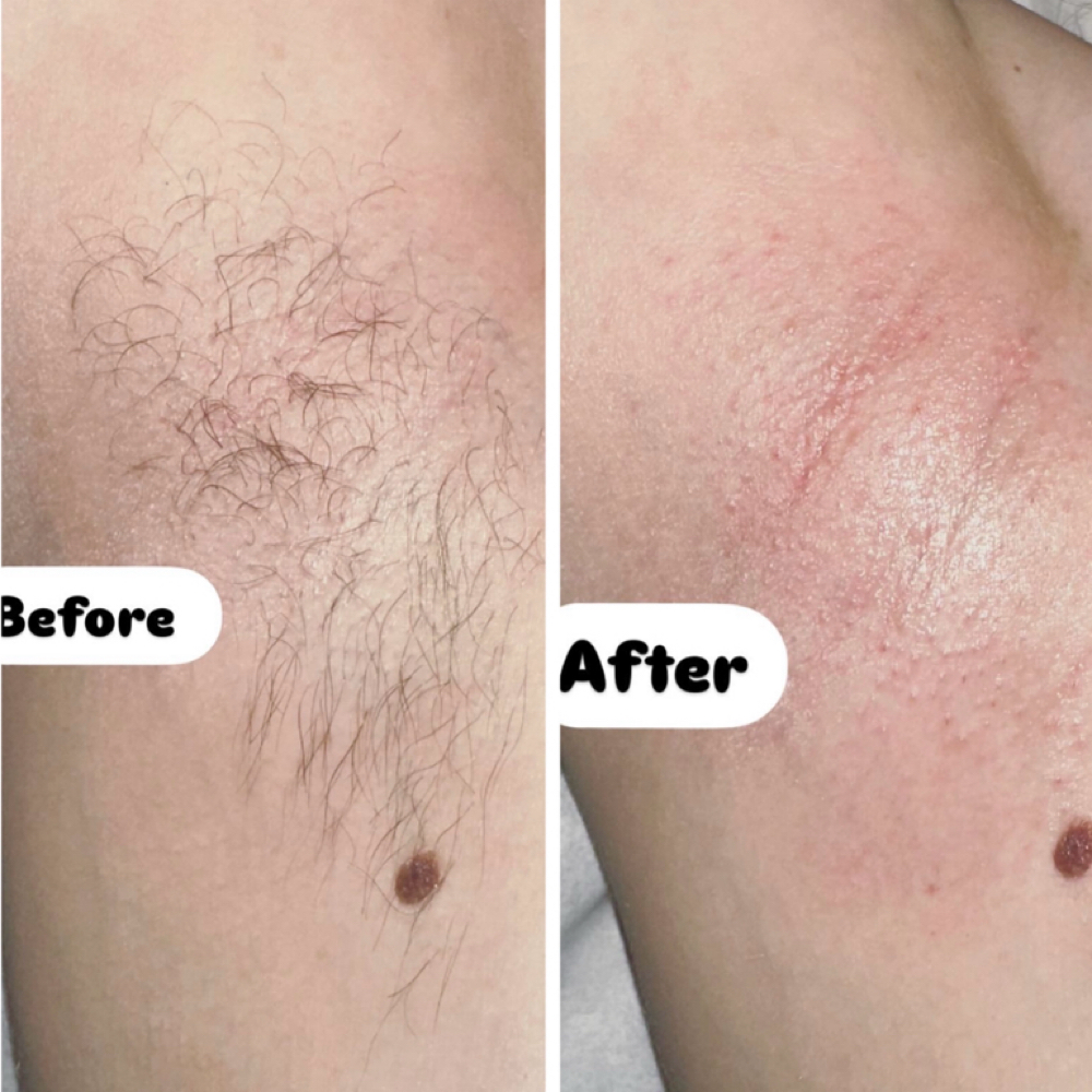 Underarm Wax at Esthetics by Eleyna Marie LLC in Mooresville, IN
