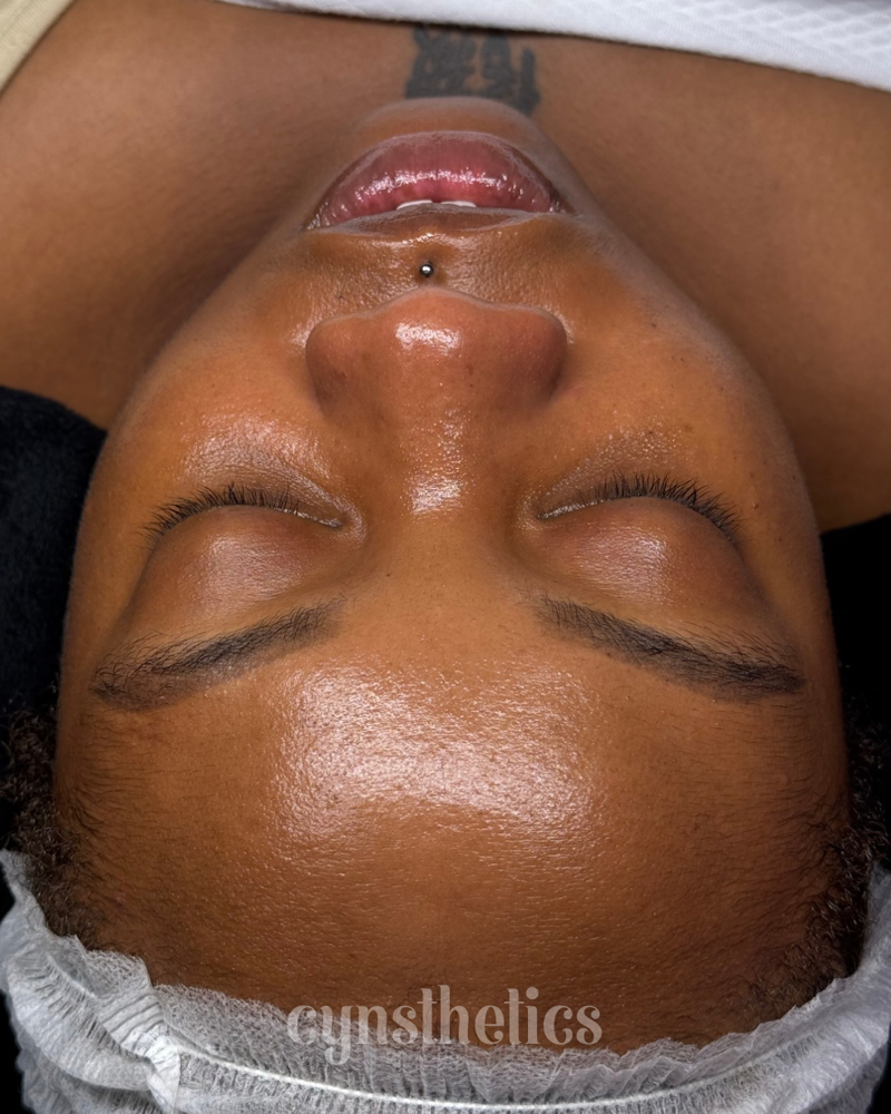 fresh start facial at Cynsthetics Skincare in Brooklyn, NY