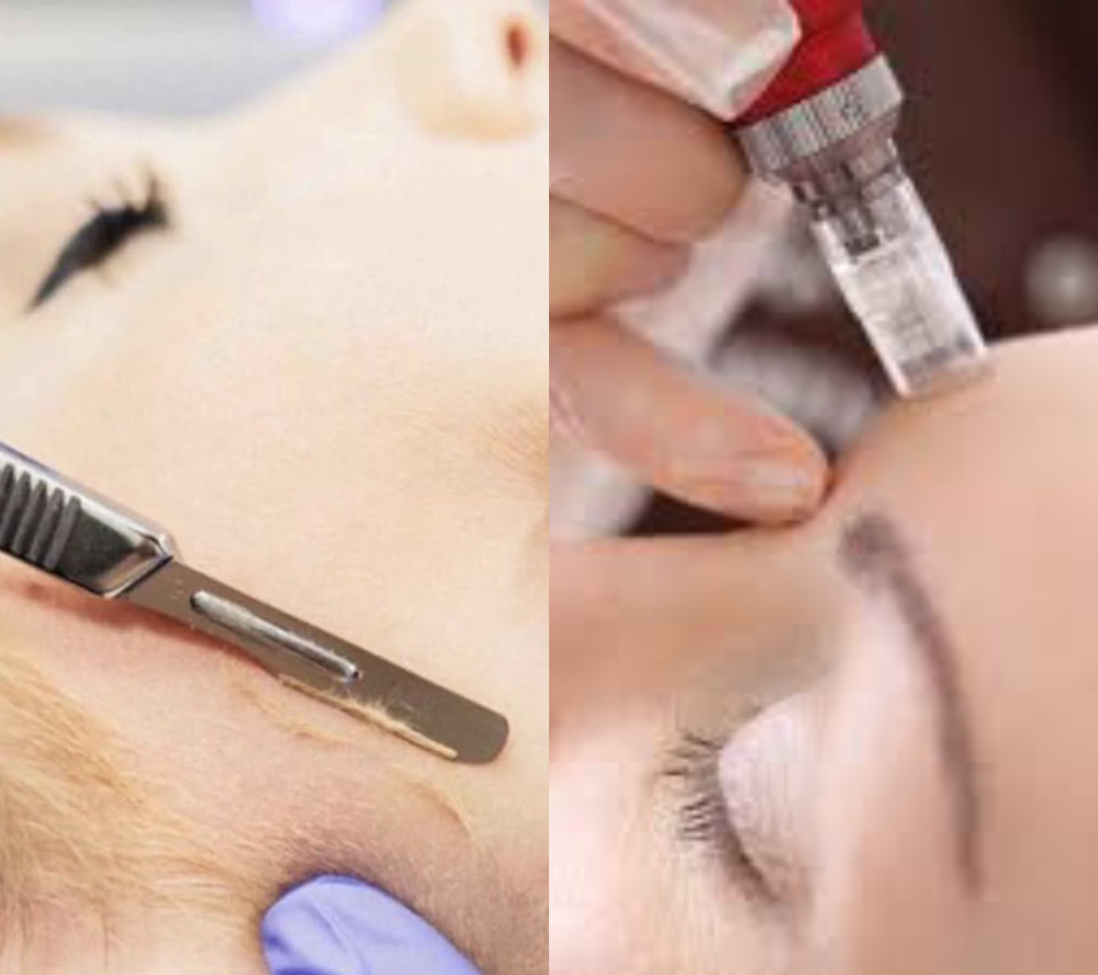 Dermaplaning + Microneedling