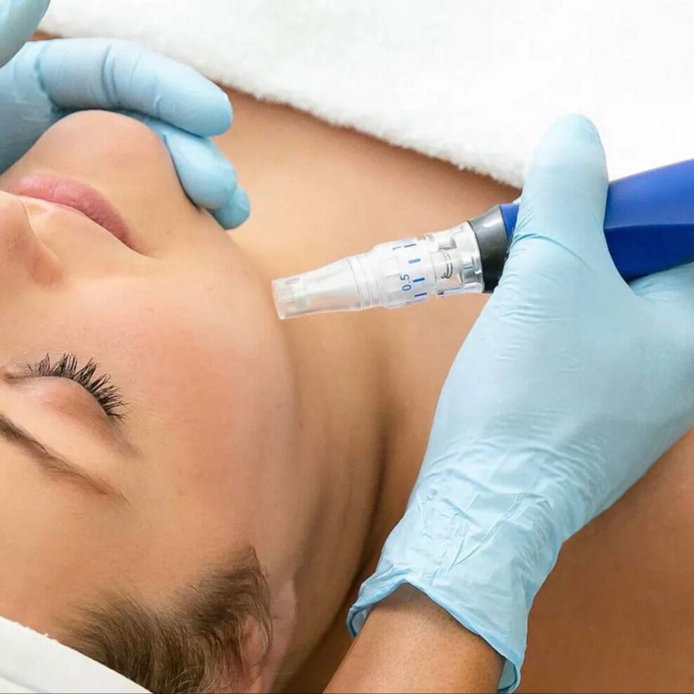 Skinpen Microneedling at Somekh Medical Aesthetics in Roslyn Heights, NY