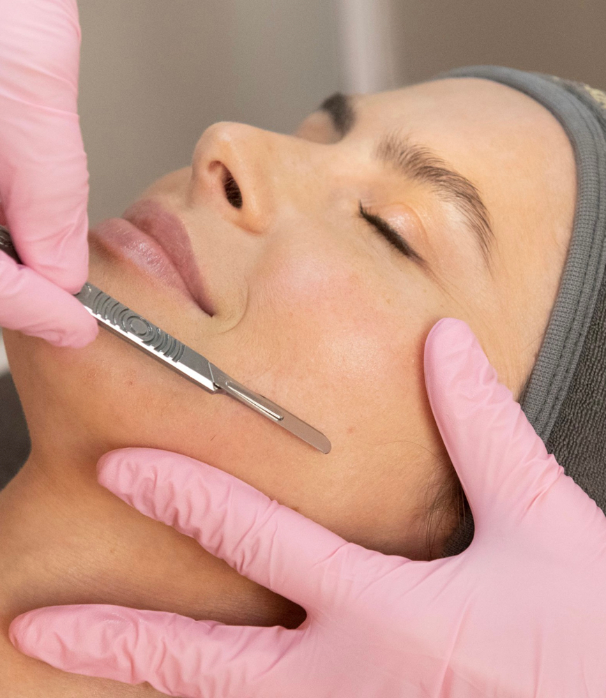 Dermaplaning Facial