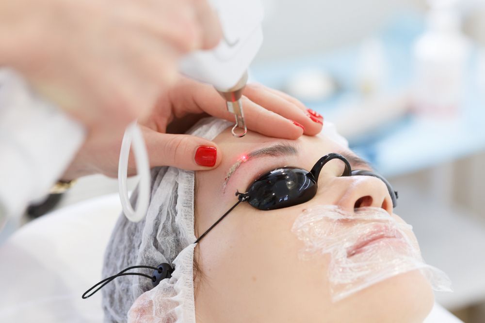 Permanent Make Up Laser Removal