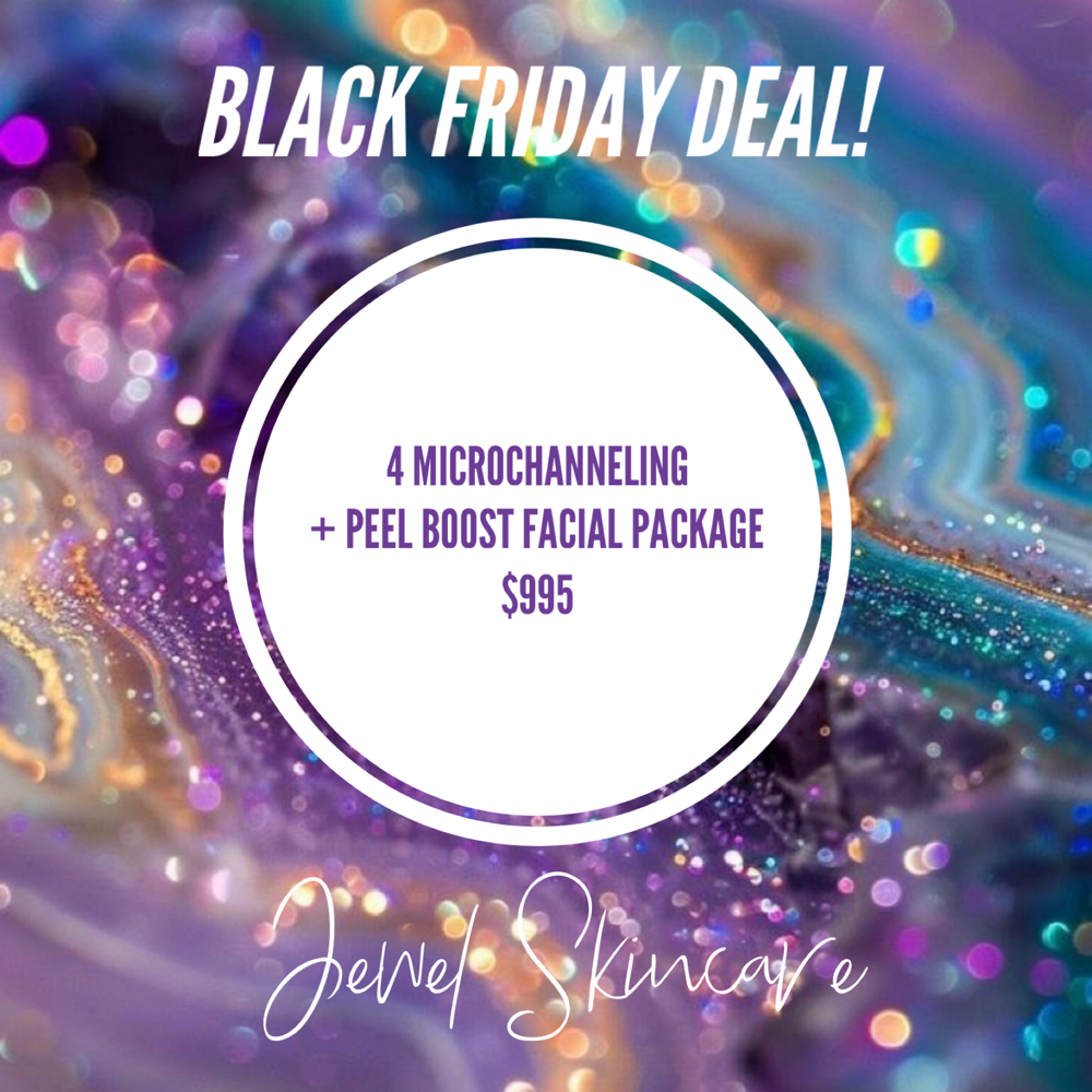 Black Friday Microchanneling Deal