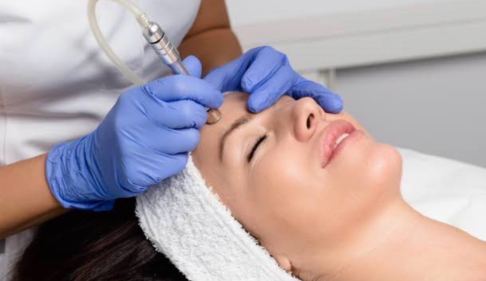 Microdermabrasion Skin Treatment