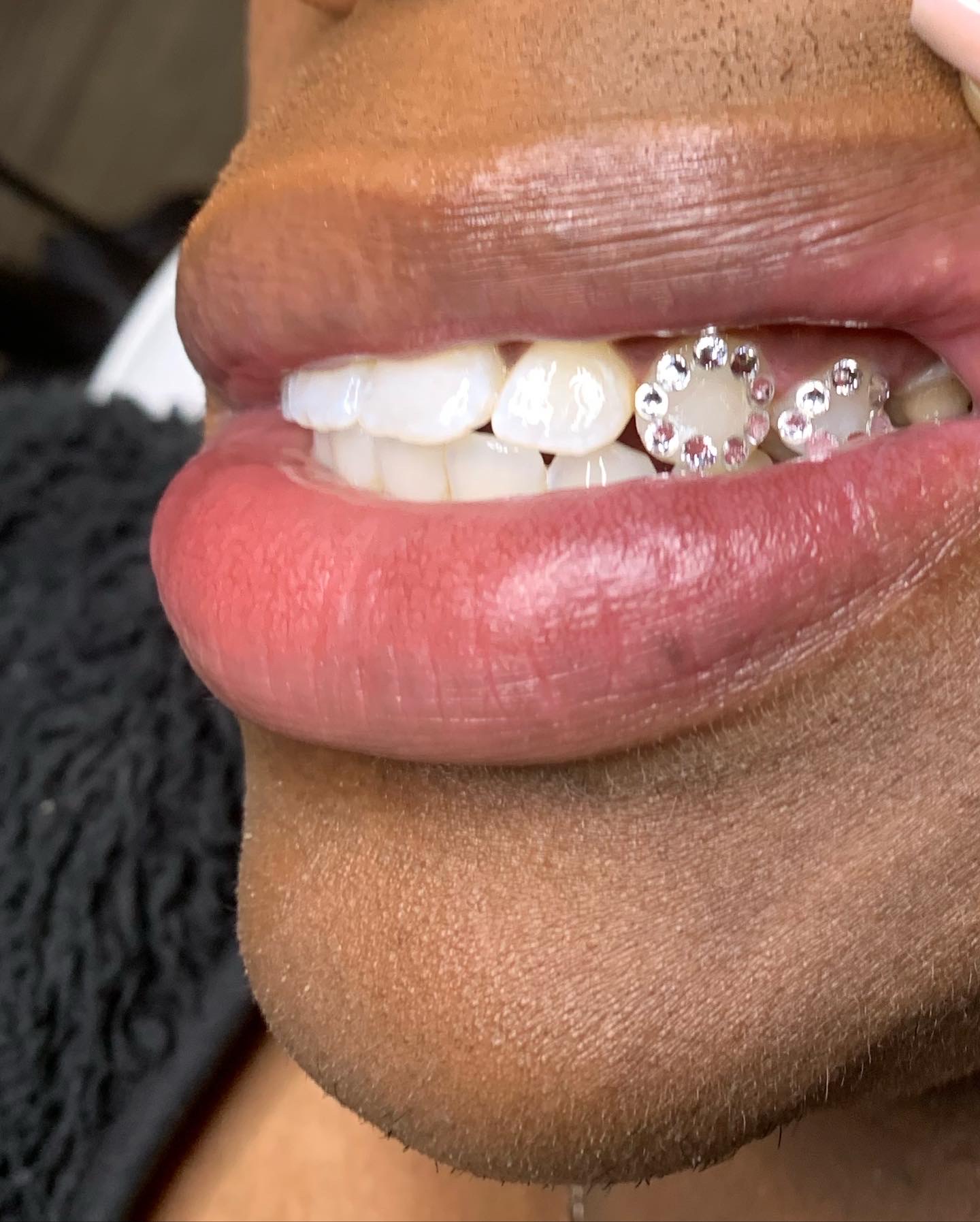 2 Tooth Gems