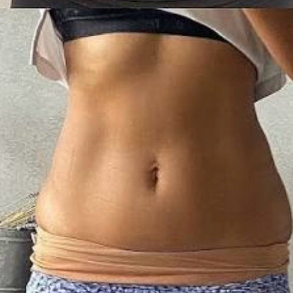 Emsculpt Treatment Promo at Luxe Beauty Bar in Brookfield, CT