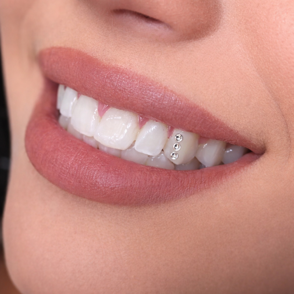 Triple Stack — Elevated Shine at Luna Smiles in Lexington, SC