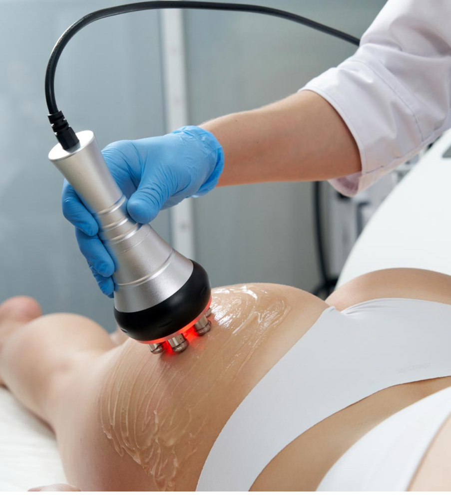 Sculpturas | Cellulite Treatment