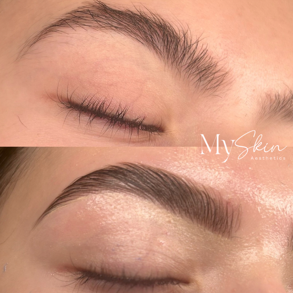 Brow Combo at MySkin Aesthetics in Laredo, TX