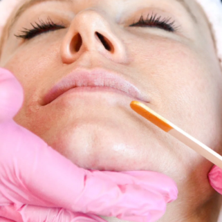 Chin Wax at Embrace Aesthetics in AURORA, CO