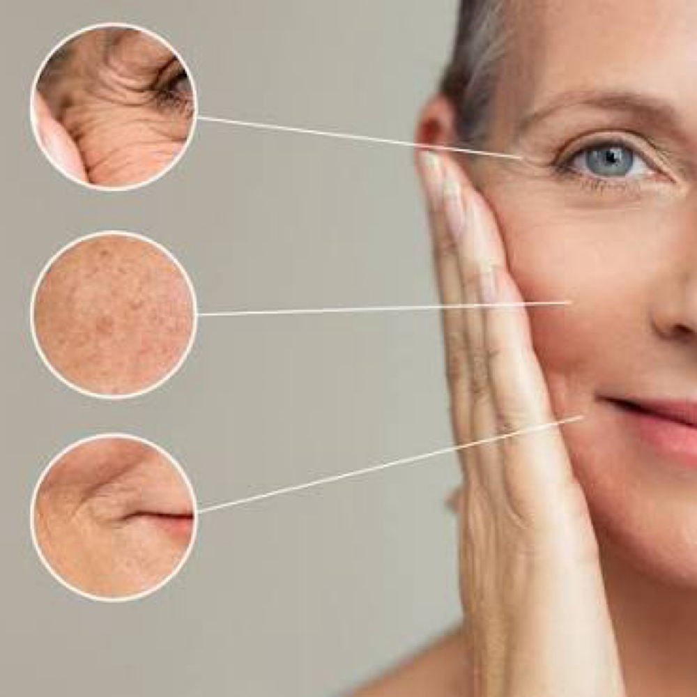 Anti-Aging at Sculpting Beauty by Pam LLC in Atascocita, TX
