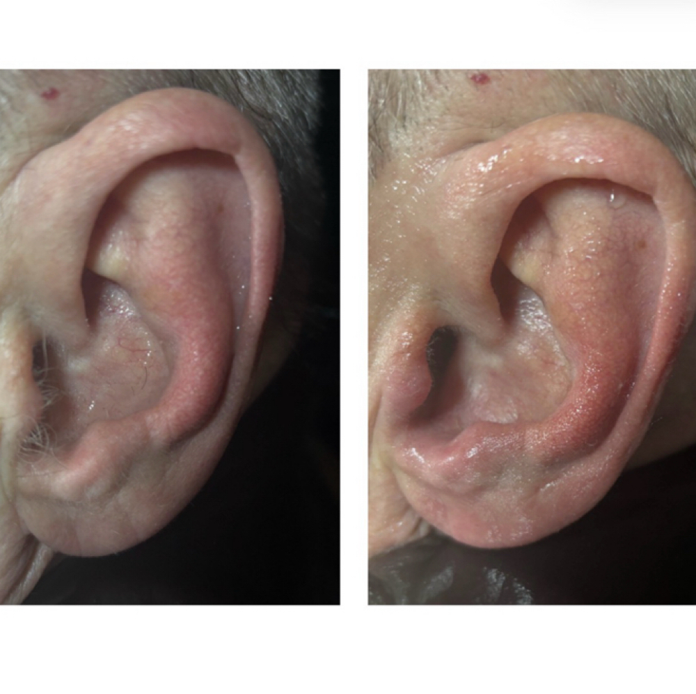 Ear Wax at Shear Energy LLC in Loganville, GA