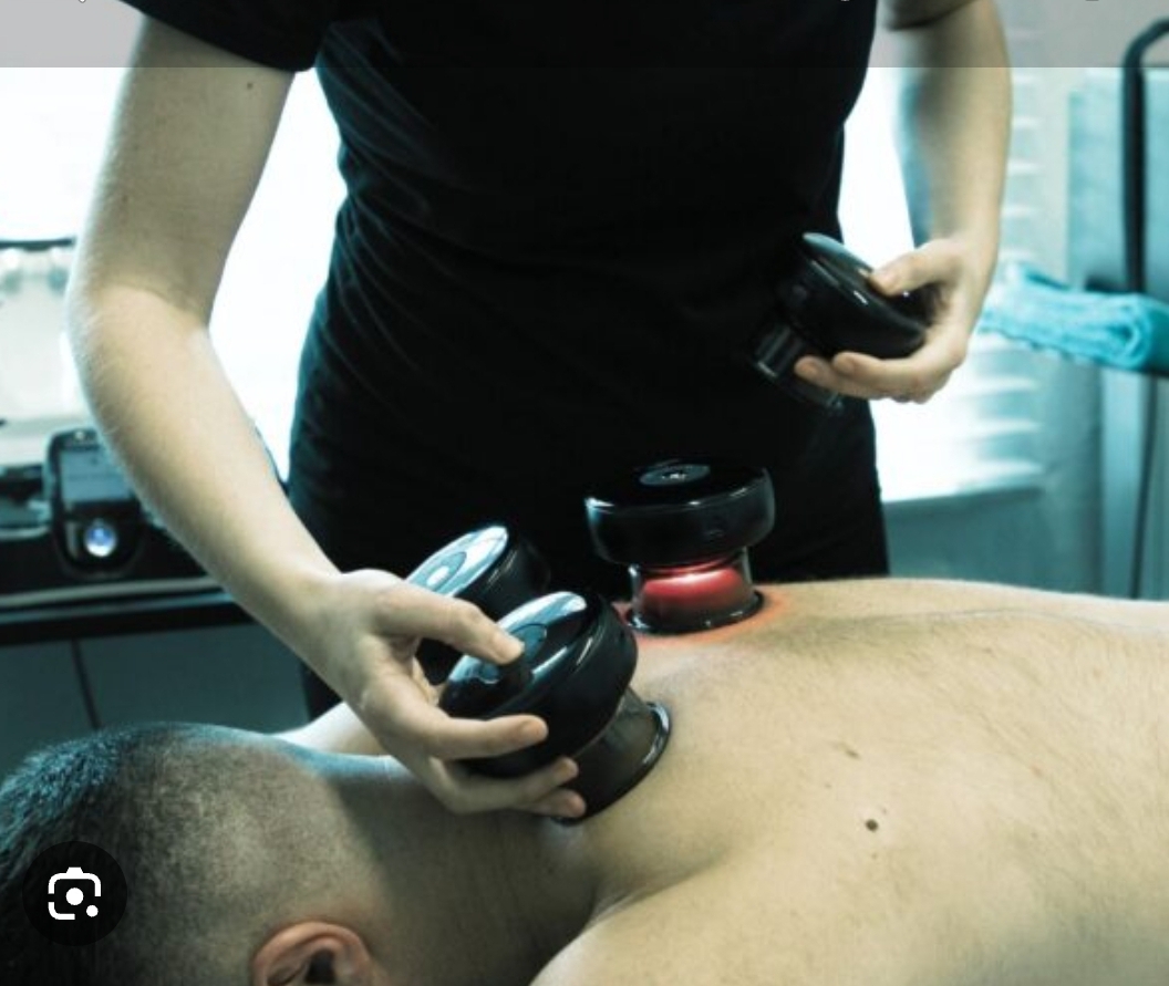 Heated Cupping