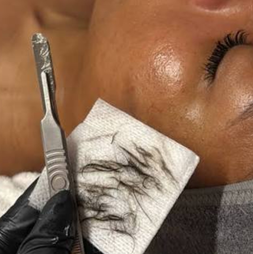 Dermaplane Facial