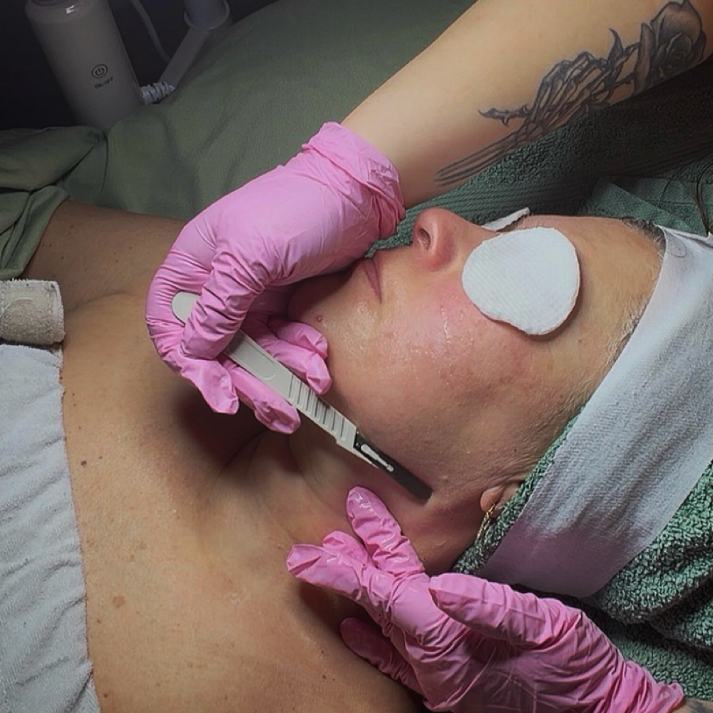 Dermaplaning Facial at EstheticsByMaddie in Lake Ronkonkoma, NY