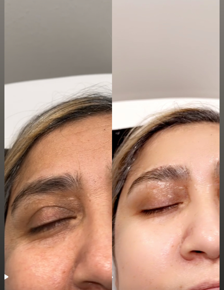 Eyebrow Lamination