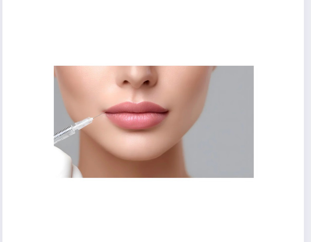 Lip Enhancement With Dermal Fillers