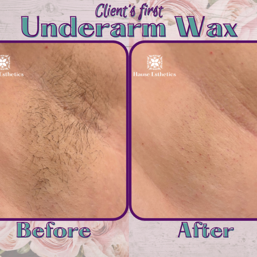 Upper Body Wax at Hause Esthetics in Morristown, TN