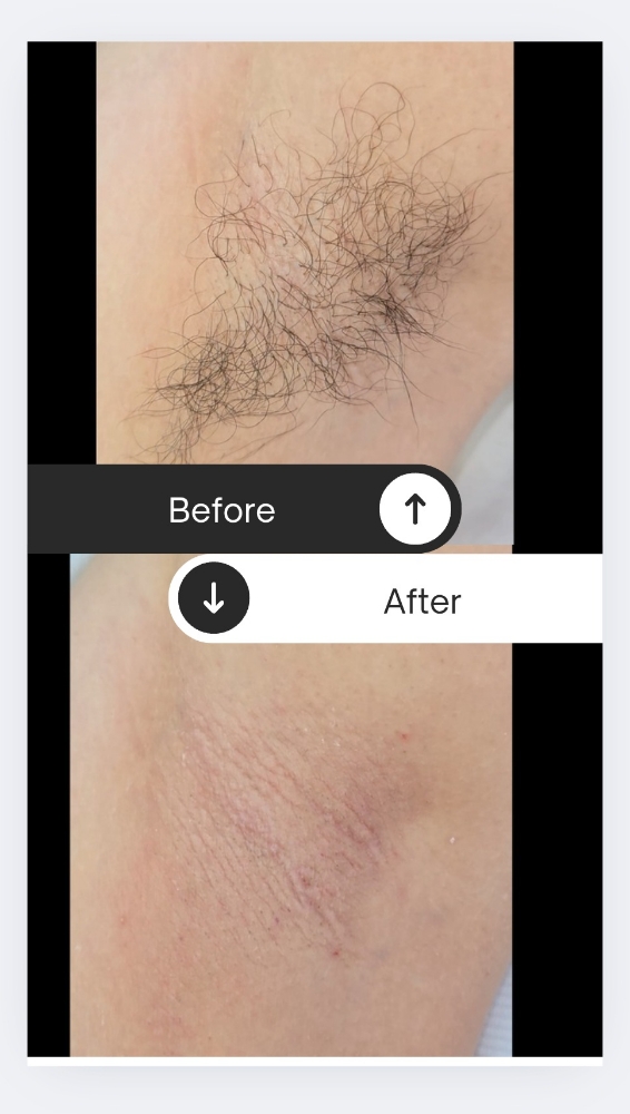 Underarm Wax