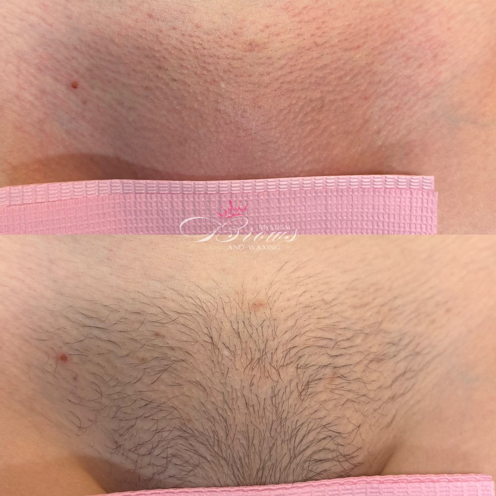 Brazilian Wax