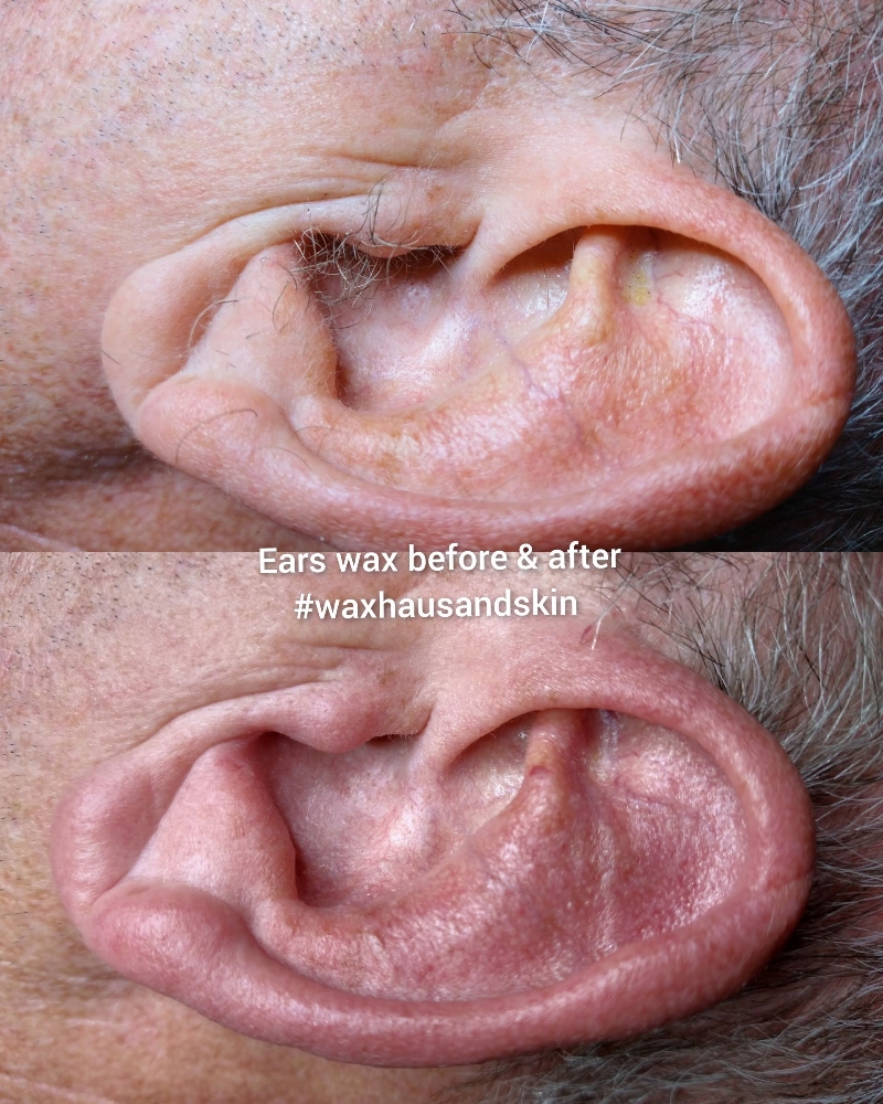 Ears Wax