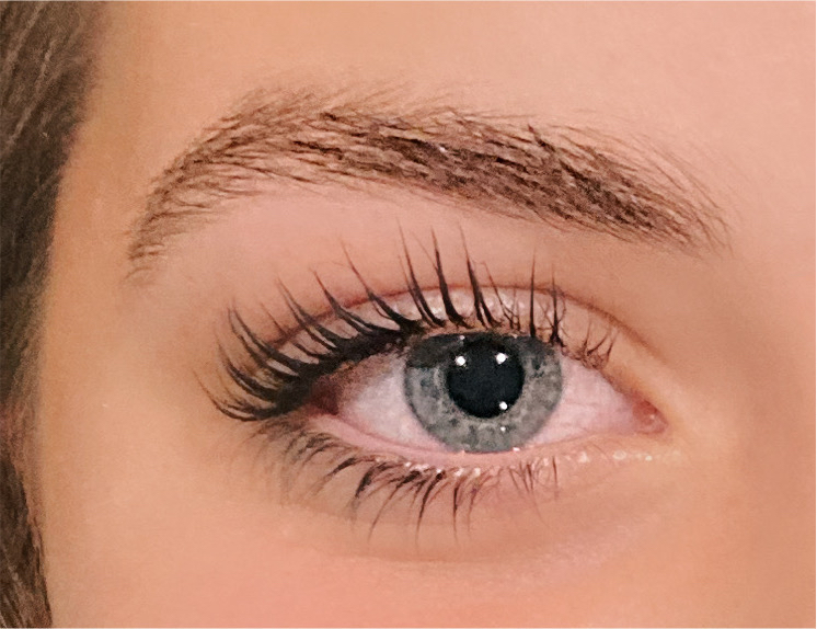 Bright Eye Treatment